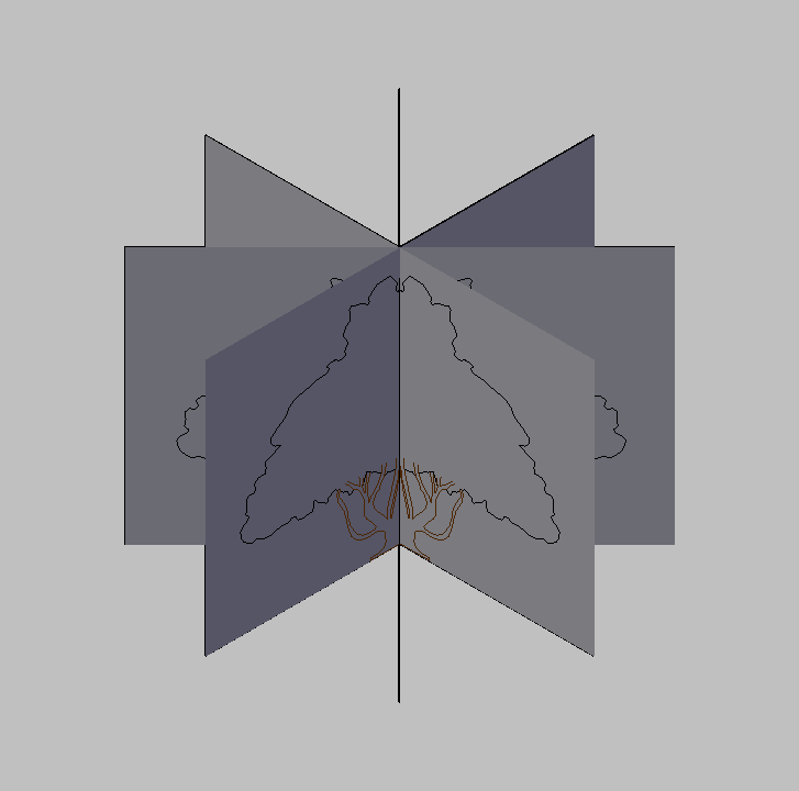 Bloque Autocad Vista de Árbol Pino 33 en 3D